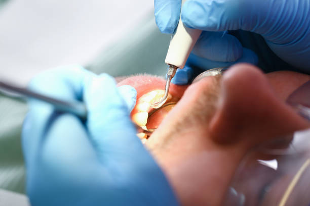 Best Emergency Dentist for Knocked-Out Tooth in Lake Hopatcong, NJ